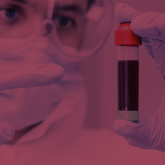 Doctor examining blood vial