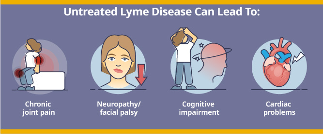 Untreated lyme disease can Lead to lyme arthritis, neurological lyme, and lyme encephalitis.
