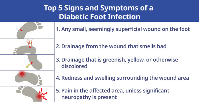 Top 5 Signs and Symptoms of a Diabetic Foot Infection